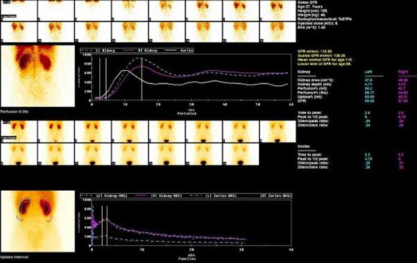 Chụp PET/CT có nguy hiểm không?