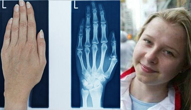 Cô gái nhìn bằng tia X - quang