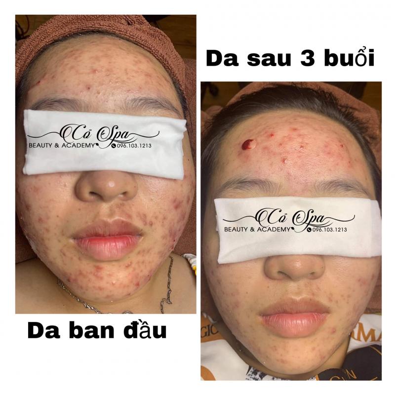 Cỏ Spa