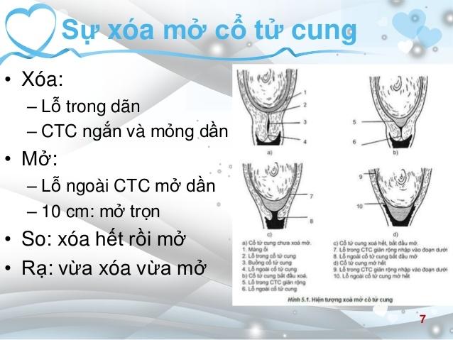 Cổ tử cung