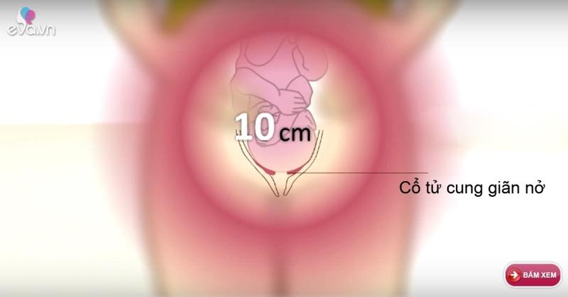 Khi cổ tử cung mở 10 phân báo hiệu bé yêu sẵn sàng chào đời