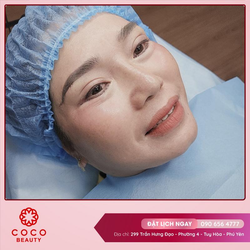 Coco Beauty - Viện Thẩm Mỹ Phú Yên