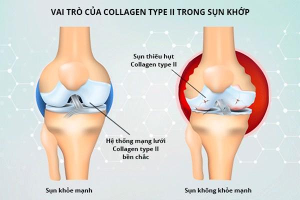 Cách tự nhiên giúp xương chắc khỏe