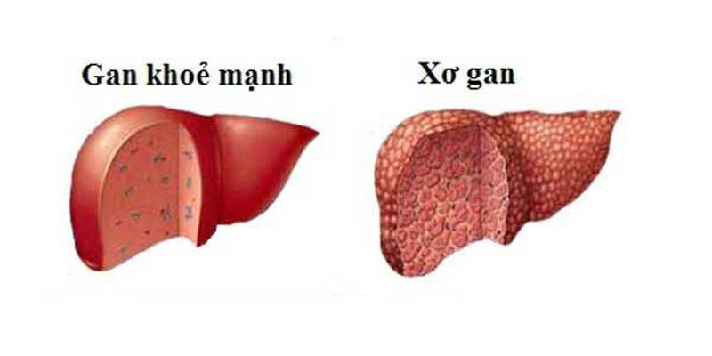 Ảnh minh họa (Nguồn internet)