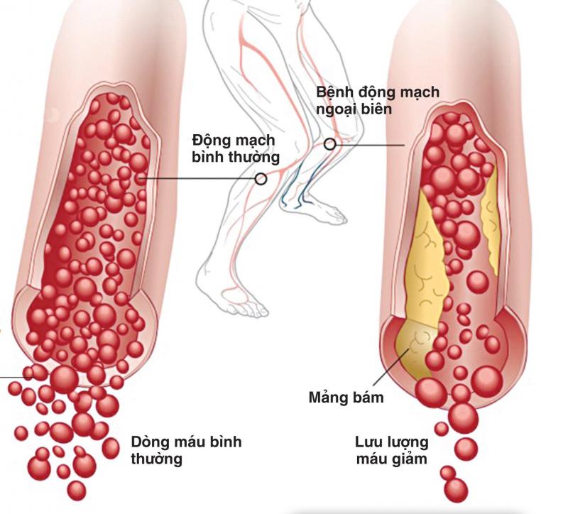 Công dụng của Naftizine