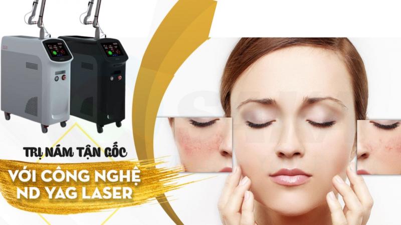 Công nghệ trị nám Q-Switched ND YAG – Triple Pulse