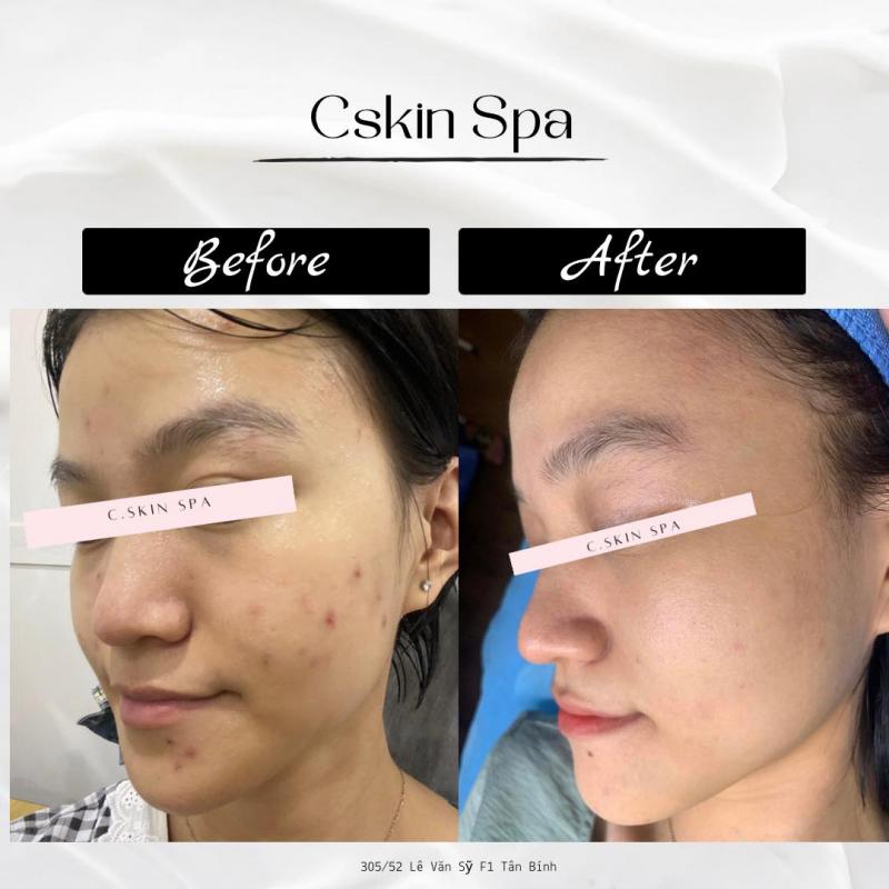 C.Skin Spa