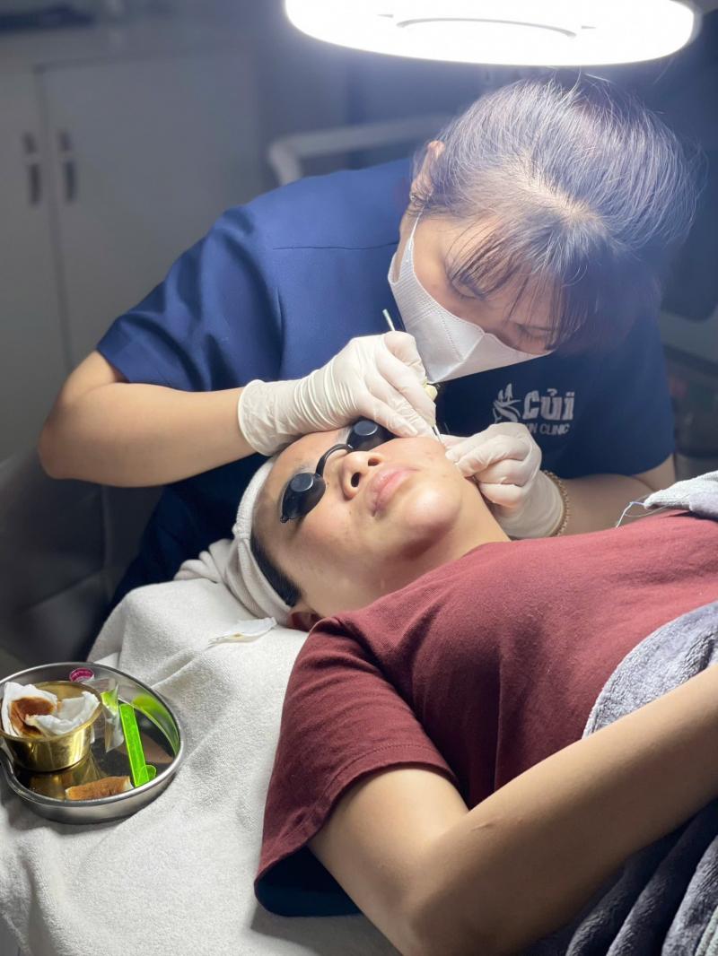 Củi Clinic - Điều Trị Da Đà Lạt