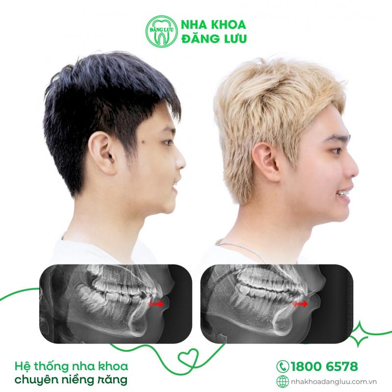 Nha Khoa Đăng Lưu