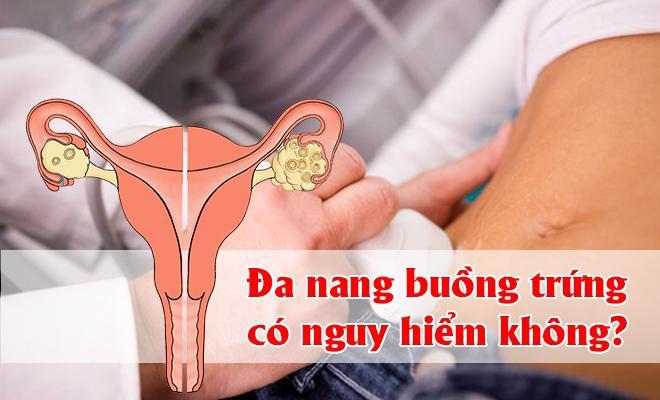 Đa nang buồng trứng có nguy hiểm không?