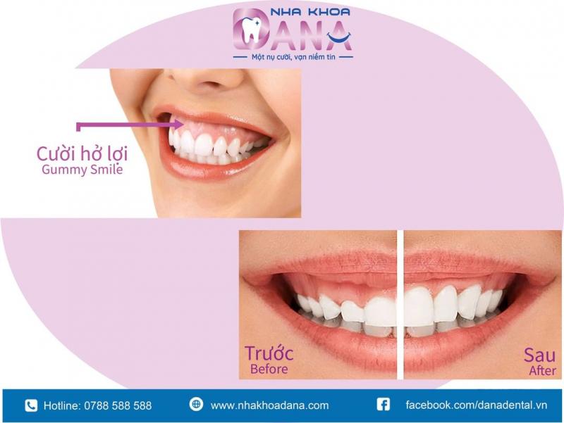 Dana Dental - Nha Khoa Đà Nẵng