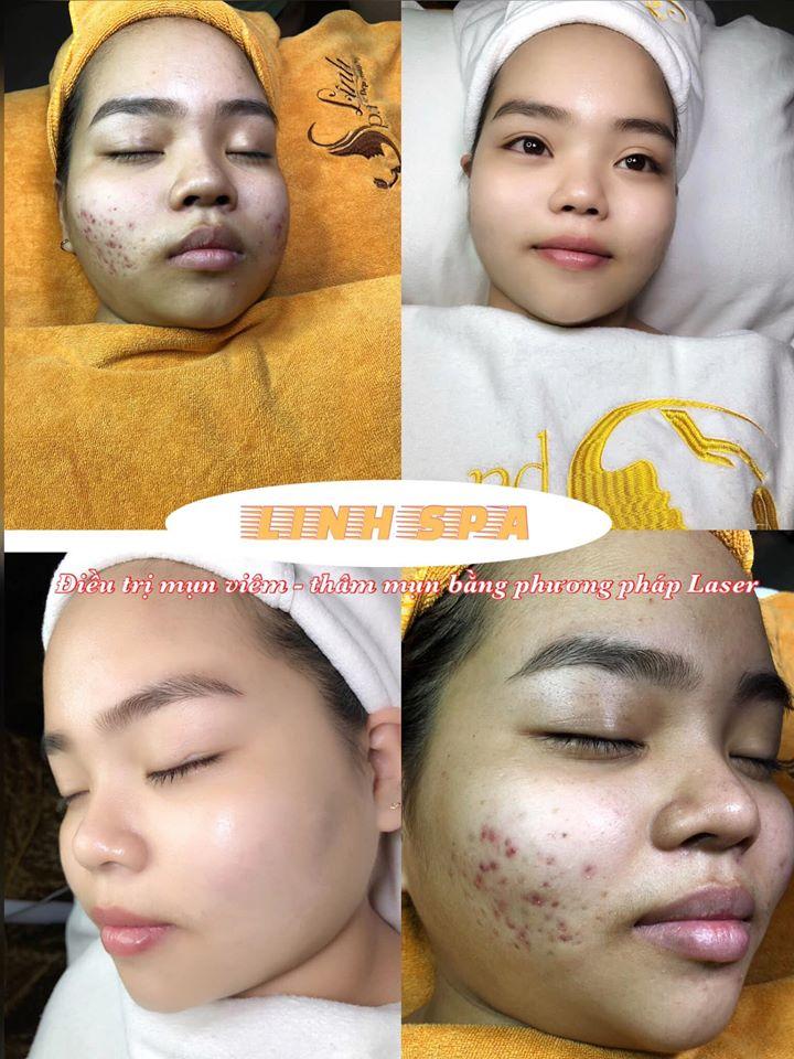 Dáng Đẹp, Sắc Xinh - Linh Spa