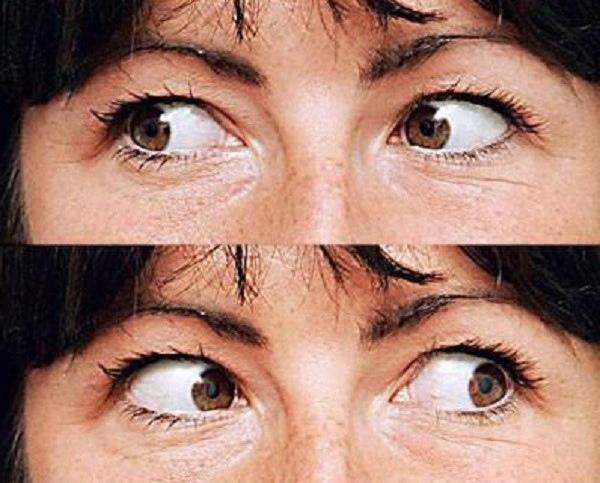 Bài tập này nới lỏng các cơ của mắt, giúp cải thiện lưu lượng máu của vùng mắt, tăng nồng độ oxy trong mắt, do đó cải thiện được thị lực.