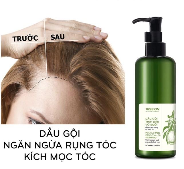 Dầu gội đầu tinh dầu vỏ bưởi  Kiss On