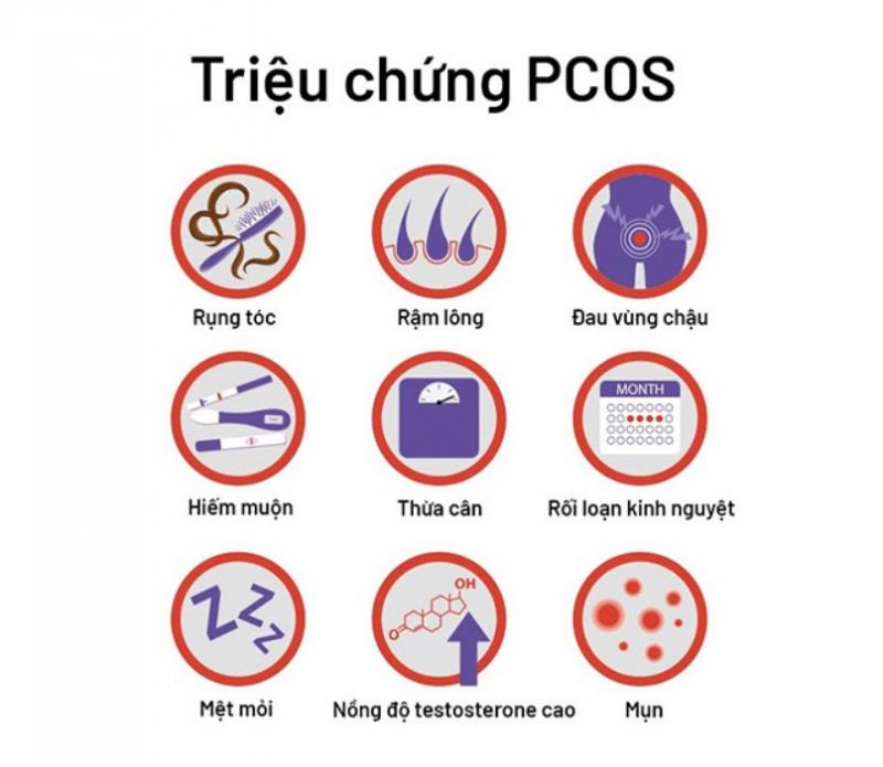 Dấu hiệu buồng trứng đa nang