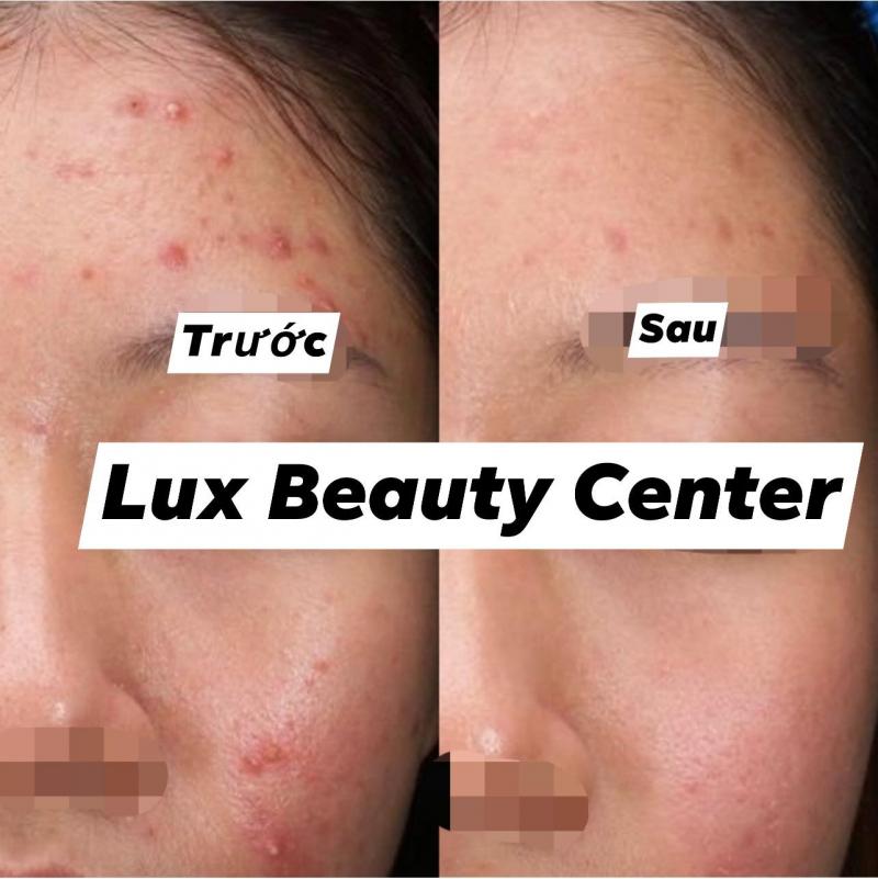 Lux Beauty Center