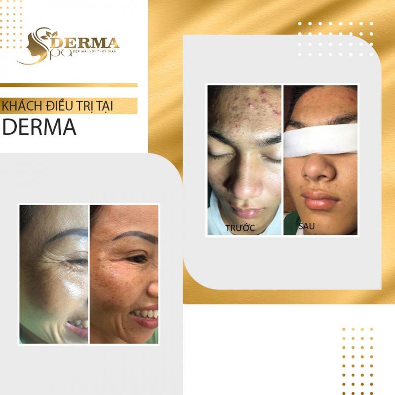 Derma Spa