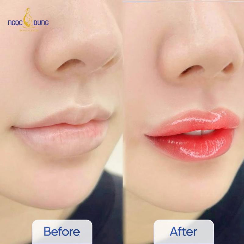 Thẩm mỹ viện Ngọc Dung