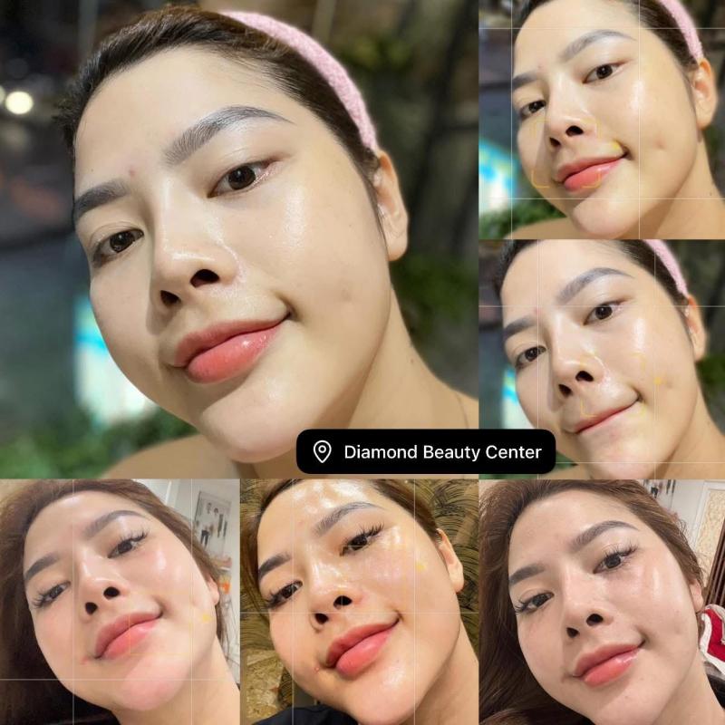 Diamond Spa - Quy Nhơn