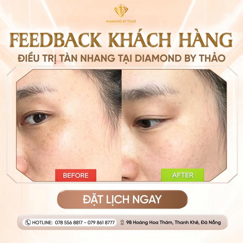 Diamond By Thảo - Thẩm Mỹ Viện Điều Trị Da Chuẩn Y Khoa