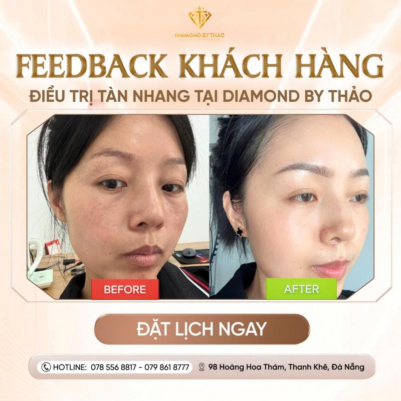 Diamond By Thảo - Thẩm Mỹ Viện Điều Trị Da Chuẩn Y Khoa