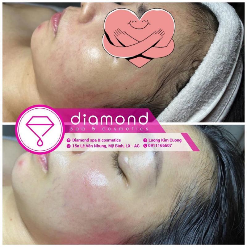 Diamond Spa & Cosmetics