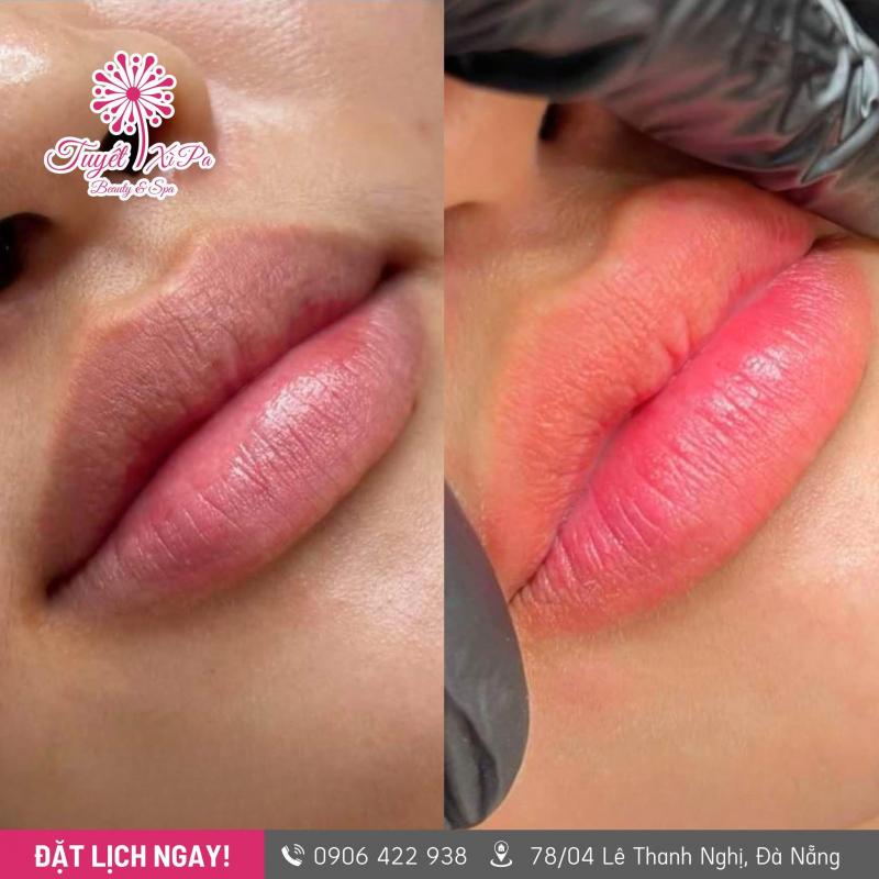 Dịch vụ khử thâm môi của Tuyết Xì Pa