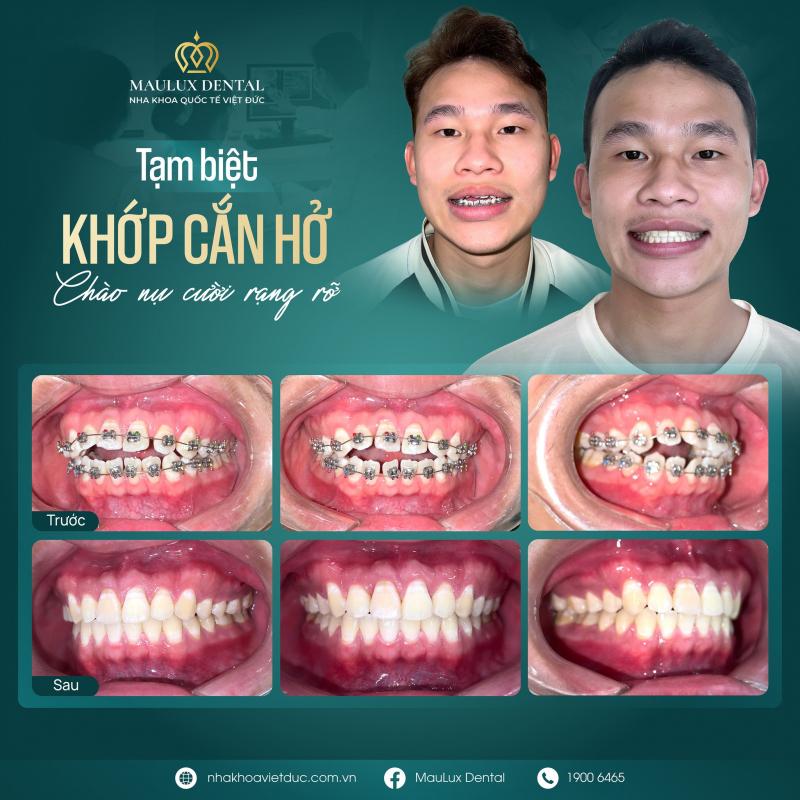 Nha khoa Quốc tế Việt Đức