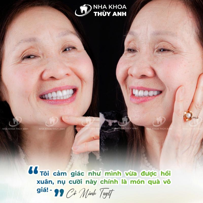 Dịch vụ nổi bật của Nha khoa Thùy Anh