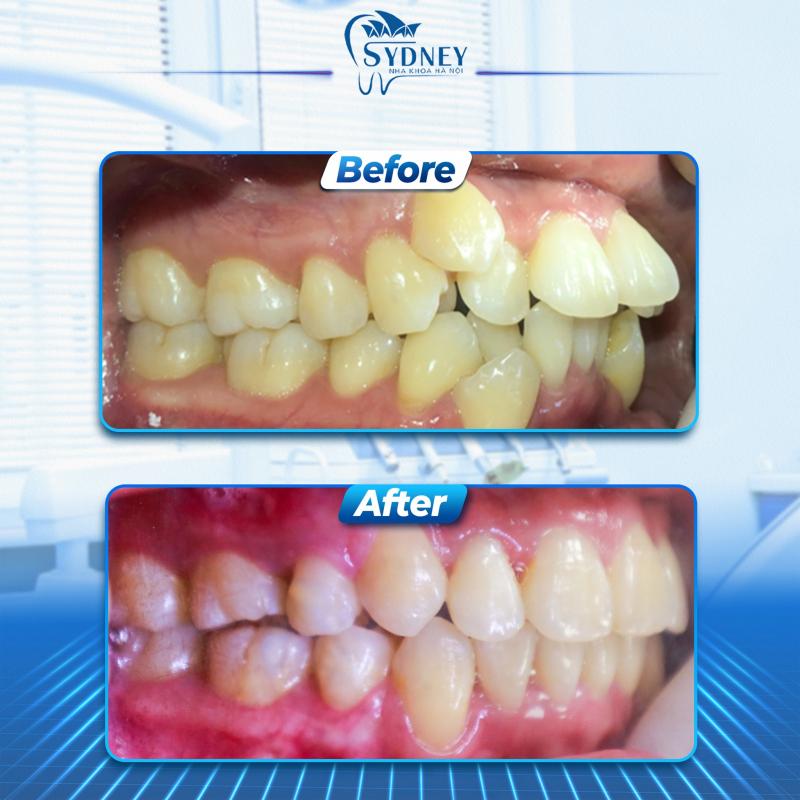 Dịch vụ nổi bật của Trung tâm nha khoa Hà Nội Sydney