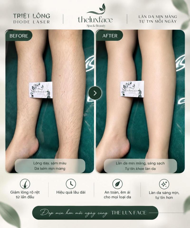 Dịch vụ triệt lông tại The Lux Face
