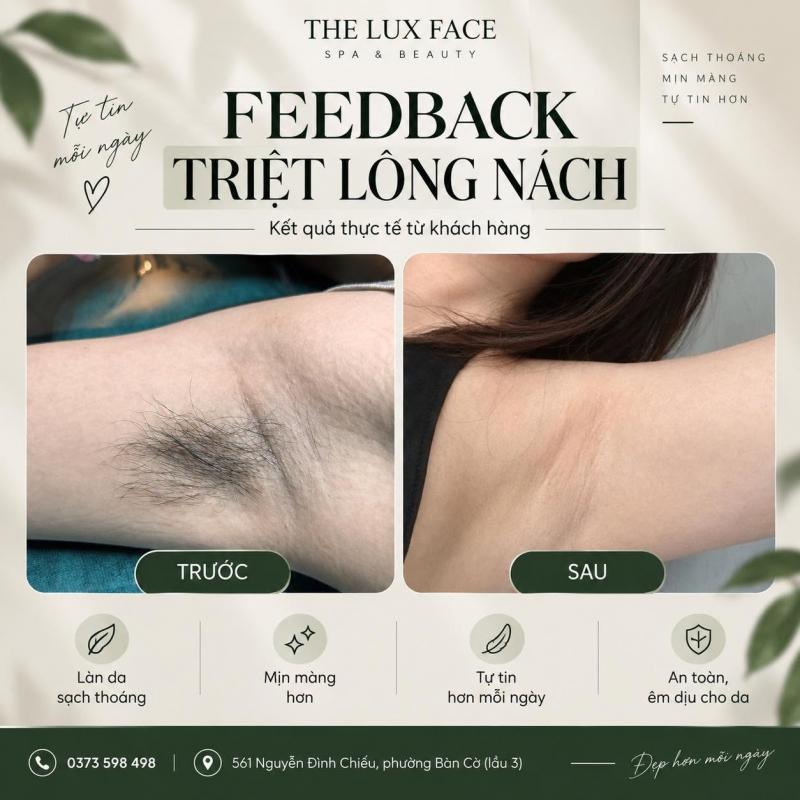 Dịch vụ triệt lông tại The Lux Face