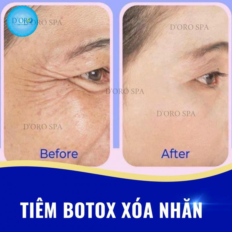 D’oro Beauty - Tiêm Filler Botox uy tín tại Đà Nẵng