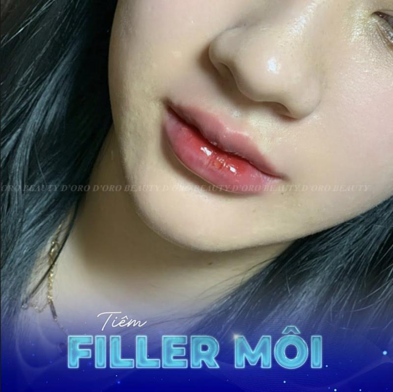 D’oro Beauty - Tiêm Filler Botox uy tín tại Đà Nẵng