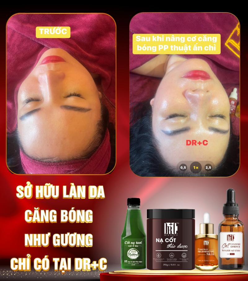 Sau khi chăm sóc, V - skin còn chuẩn bị thuốc cho khách sử dụng khi về nhà, tự chăm sóc bản thân