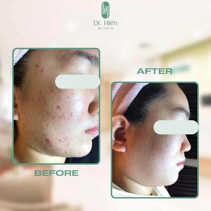 Dr Hiền Clinic & Spa