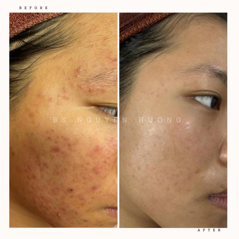 Dr Hương Spa & Clinic