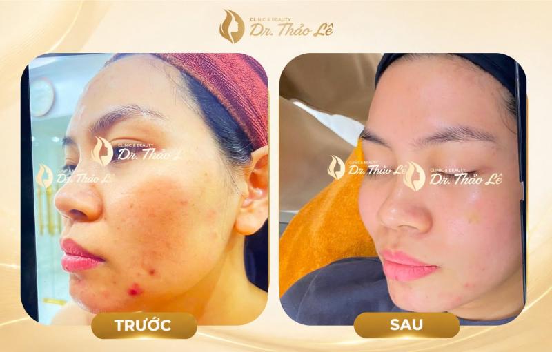 Dr. Thảo Lê - Phòng Khám Da Liễu Hải Phòng