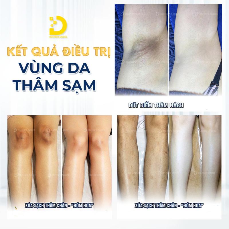 Dr.Choice Clinic – Chuyên trị da thâm chuẩn y khoa uy tín ở TpHCM