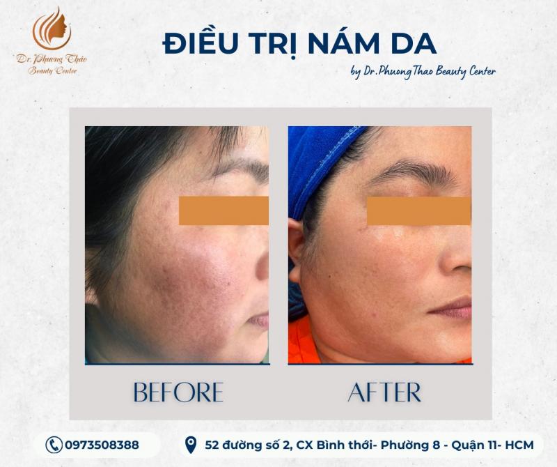 DrPhương Thảo beauty spa