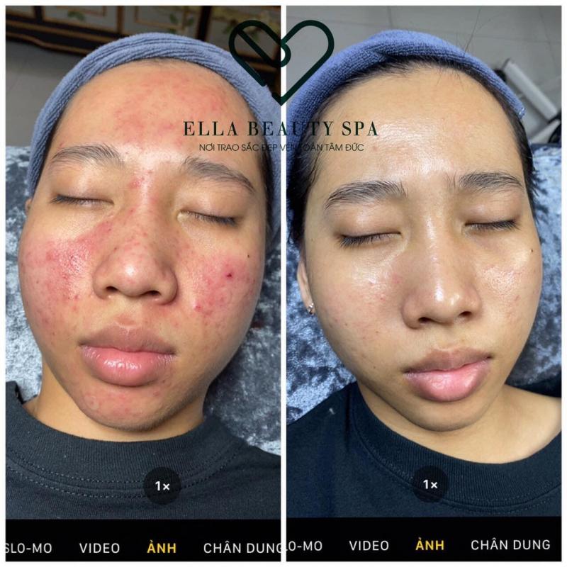 Ella Beauty Spa