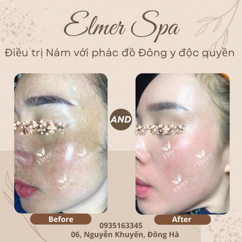 Elmer Spa Đông Y