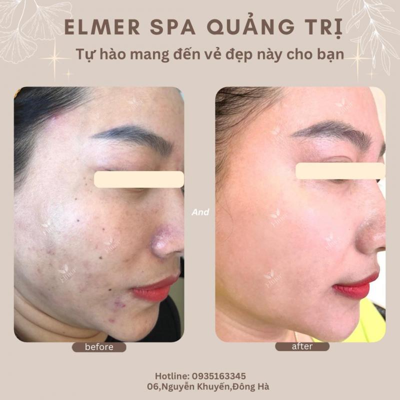 Elmer Spa Đông Y