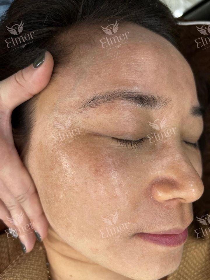 Elmer Spa Đông y - Chi nhánh Mê Linh