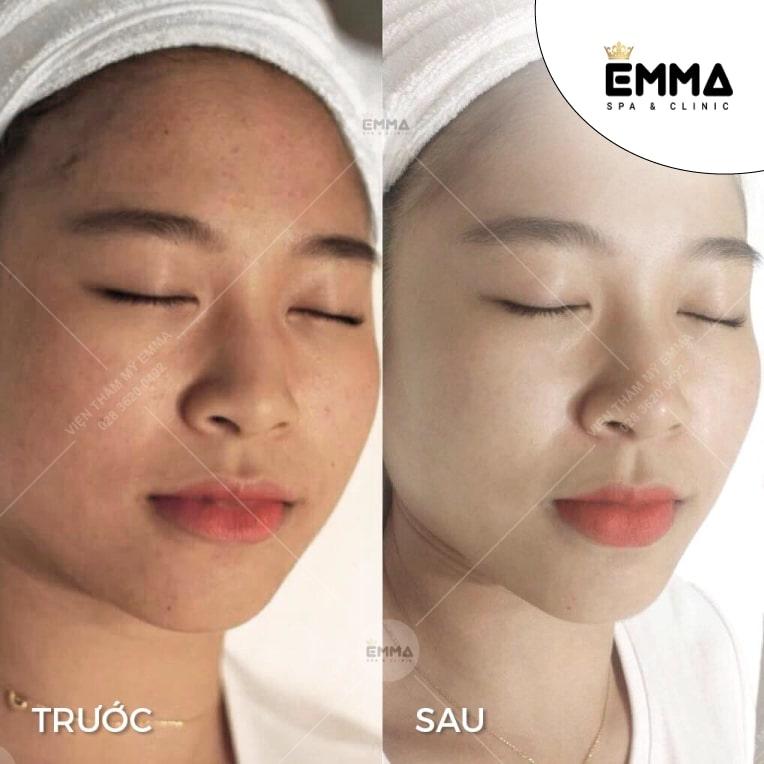 Emma Spa & Clinic