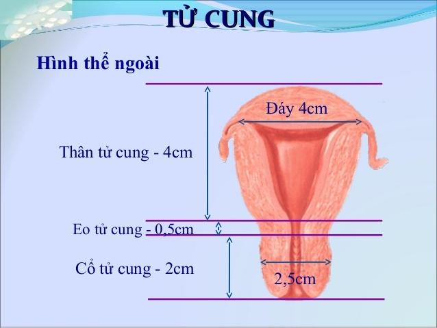 Eo tử cung