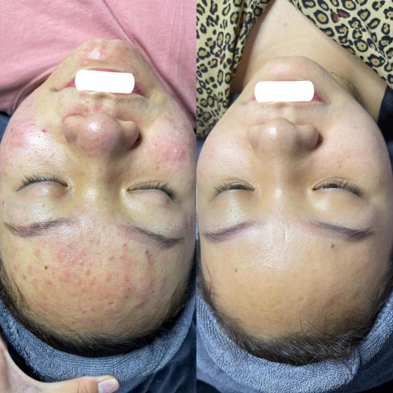 Eva Beauty Spa Lạng Sơn