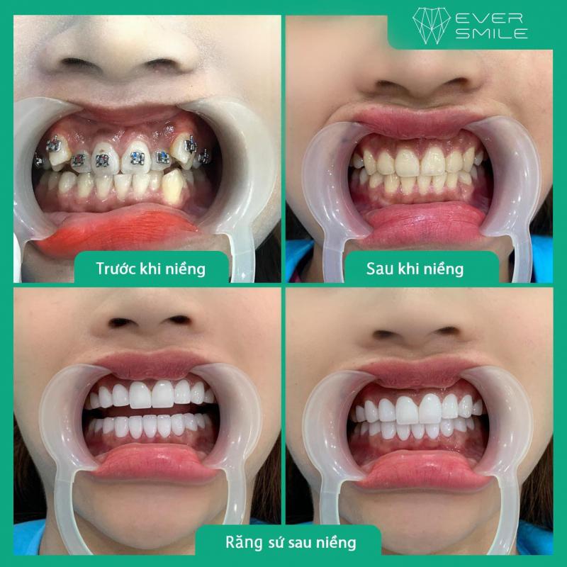 Ever Smile - Nha Khoa Thẩm Mỹ Quốc Tế