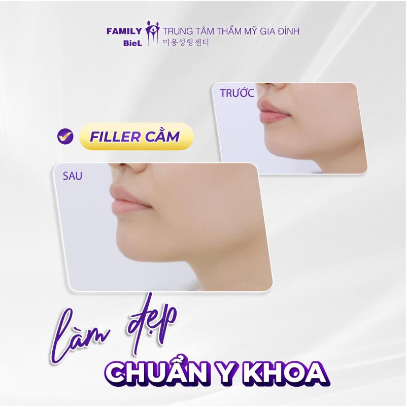 Family BieL - Tiêm Filler An Toàn, Làm Đẹp Chuẩn Y Khoa