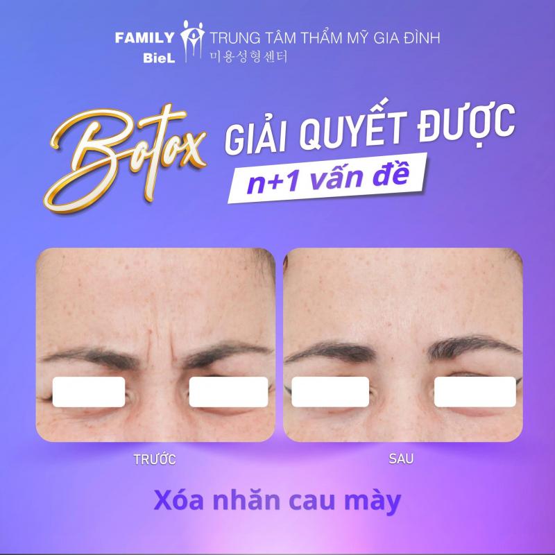 Family BieL - Tiêm Filler An Toàn, Làm Đẹp Chuẩn Y Khoa